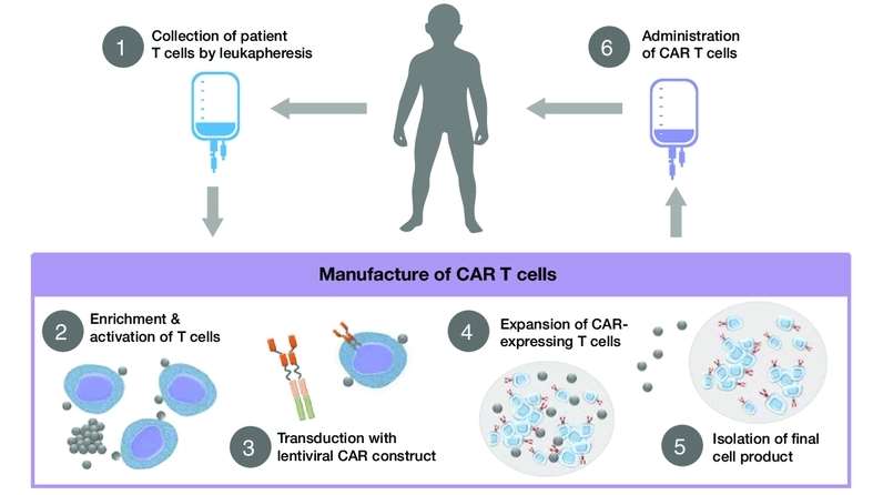 Diagram of CAR T cell treatment process (Hucks et al., 2019)
