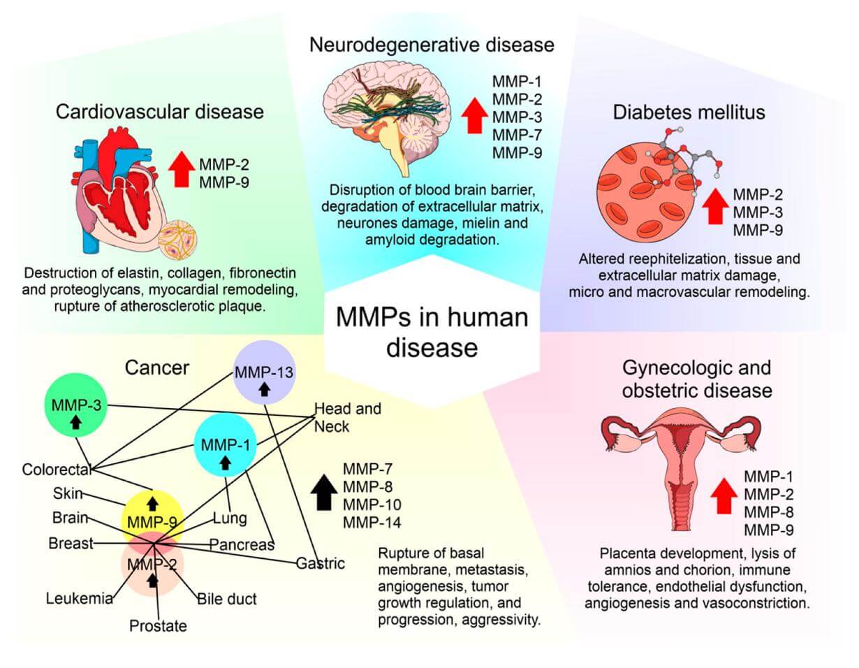 MMPs play distinguishing roles in the pathogenesis of multiple common human diseases