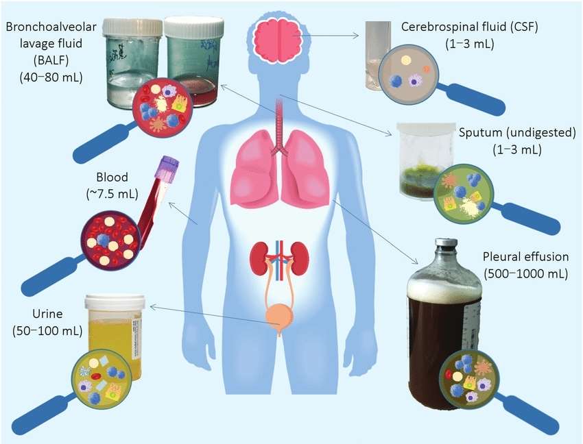 The typically used body fluid samples